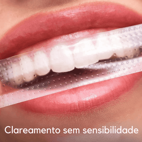 SmileKit – Clareamento total em 30 minutos