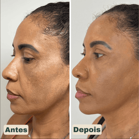 CollageSkin – Máscara Anti-idade com Efeito Lifting