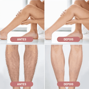Depilador Elétrico 4 em 1 - DermaBelle® + Brindes