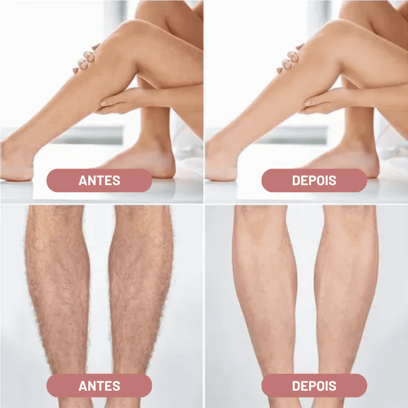 Depilador Elétrico 4 em 1 - DermaBelle® + Brindes