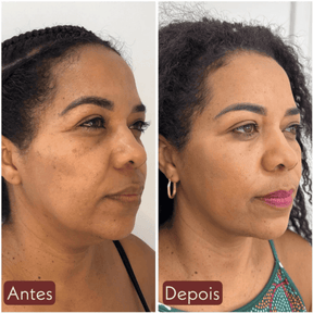 CollageSkin – Máscara Anti-idade com Efeito Lifting