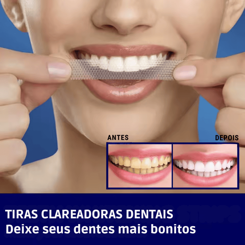 SmileKit – Clareamento total em 30 minutos