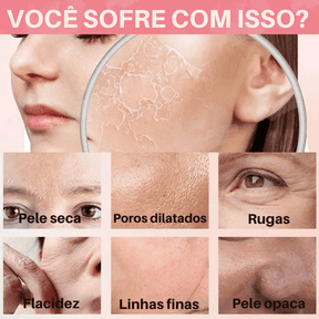 CollageSkin – Máscara Anti-idade com Efeito Lifting